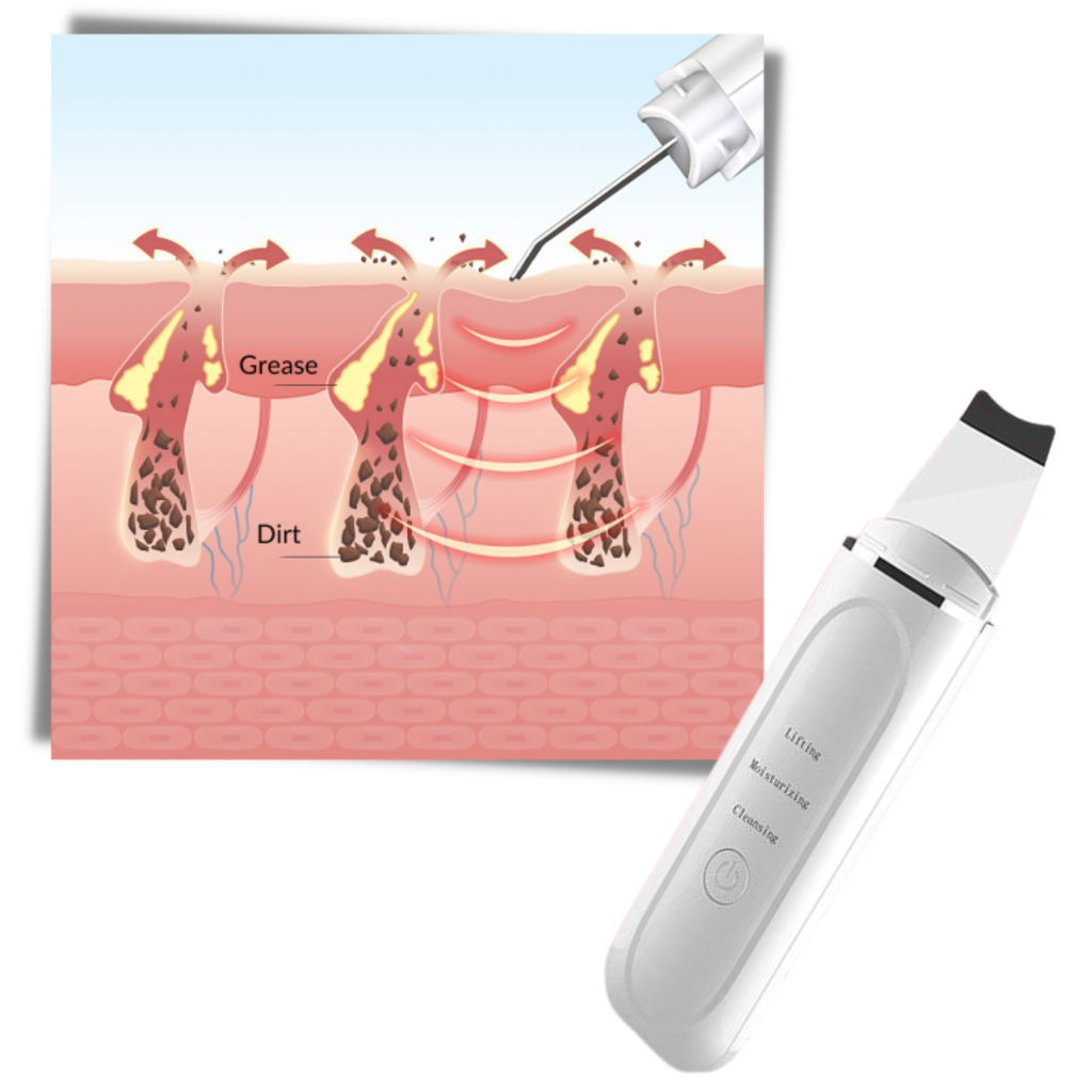 Spatule exfoliante ultrasonique pour le visage