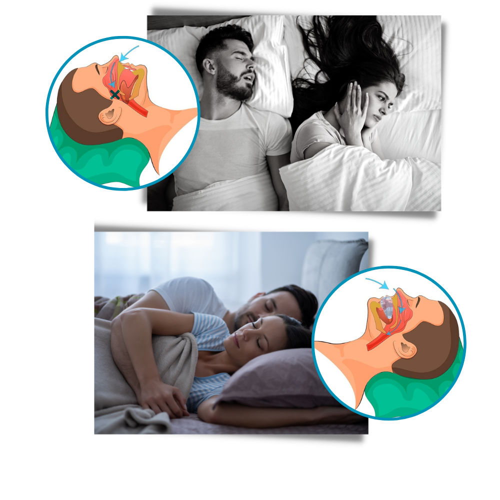 Dispositif avancé anti-ronflement