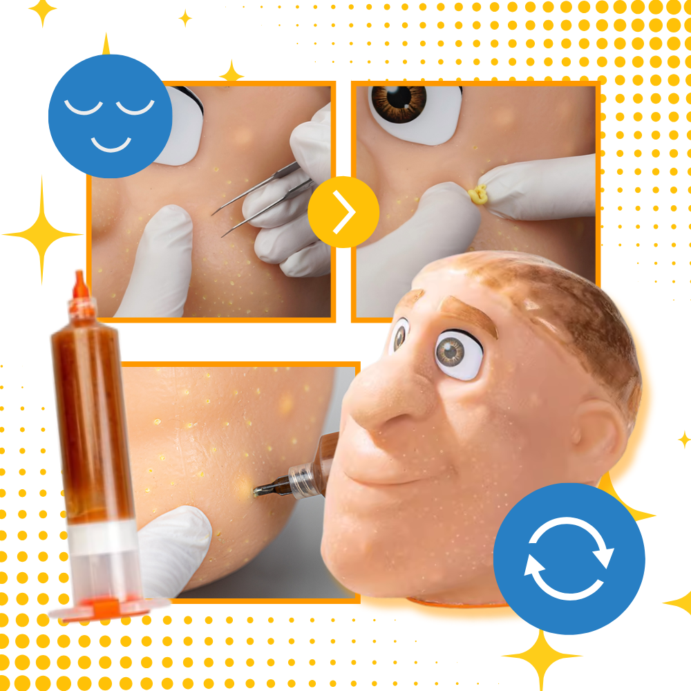 Jeu anti-stress visage en silicone pour percer les boutons