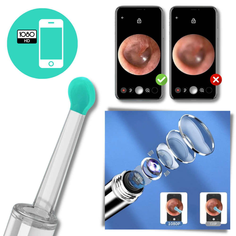 Caméra de nettoyage d'oreille pour retirer le cérumen