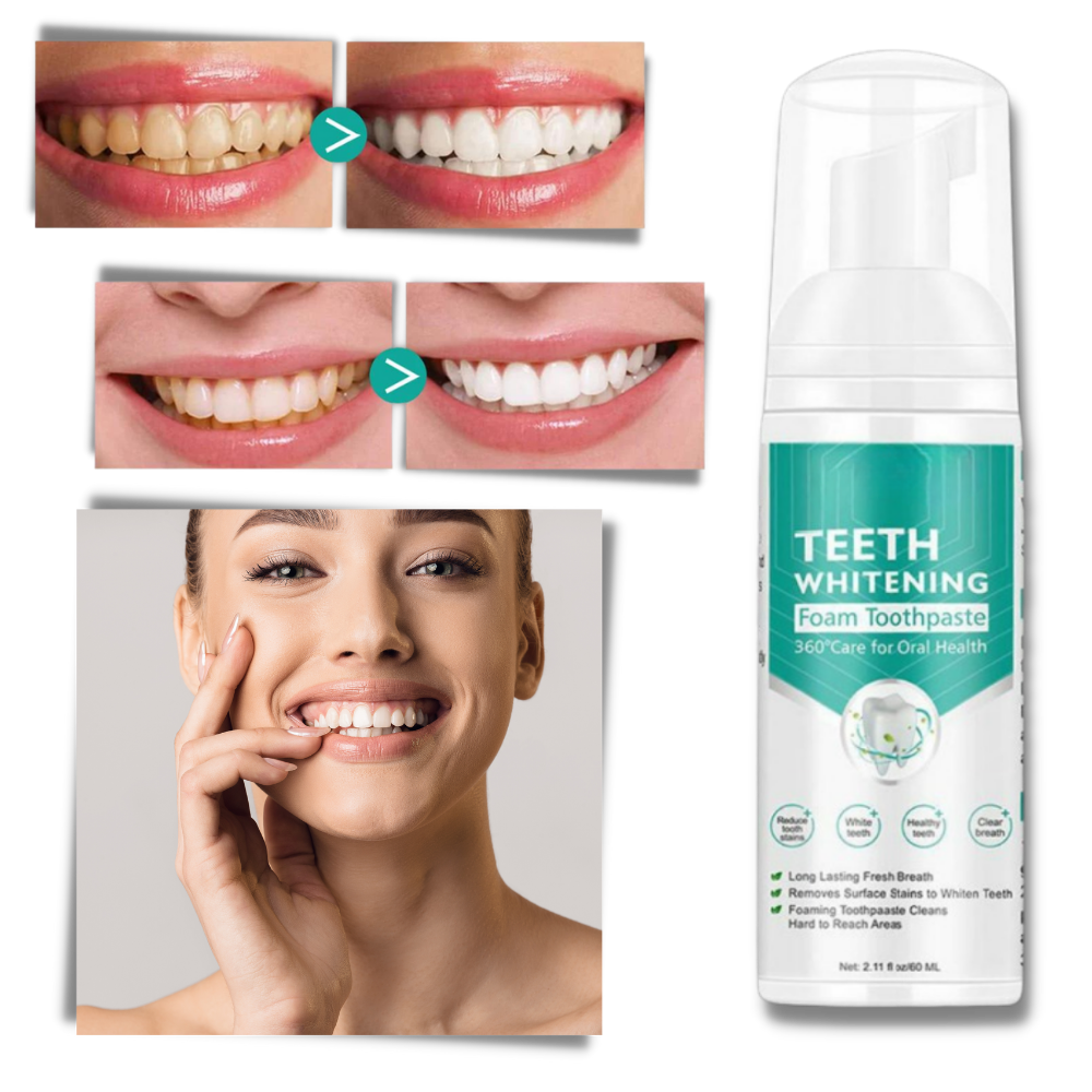 Mousse blanchissante pour les dents